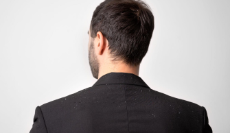 Homem com um terno preto está de costas, no cabelo e na roupa há alguns pontinhos brancos que representam a caspa.